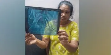 വണ്ടാനം മെഡിക്കൽ കോളേജിനെതിരെ  പ്രതിഷേധം ശക്തം